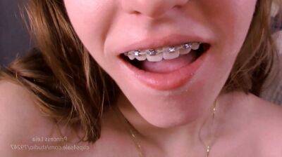 Blow it on my braces on freefilmz.com